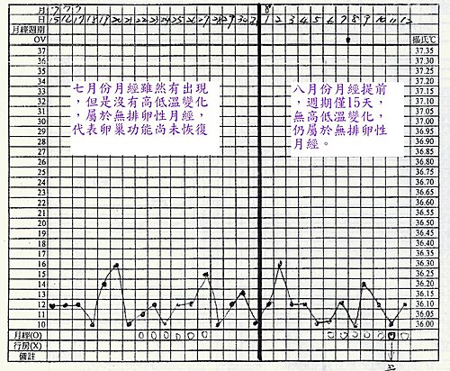 gkc-xqiusns1r3gnp1zolg